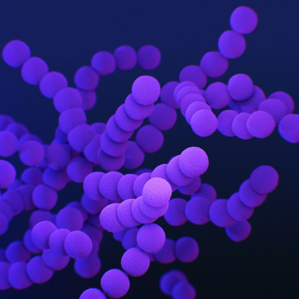 Regolamento UE sulla sicurezza alimentare per la Listeria